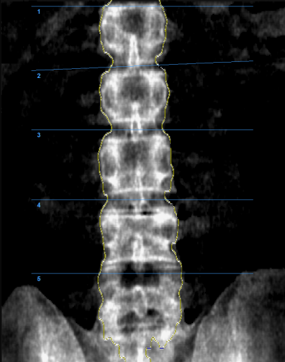 Денситометр рентгеновский Medikors InAlyzer AIR