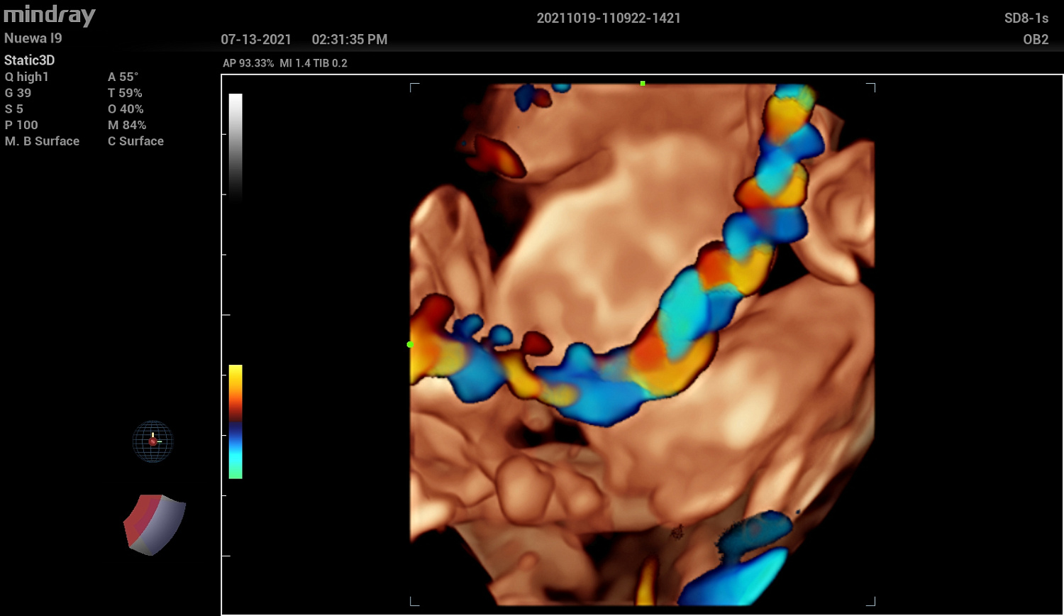 Ультразвуковой аппарат Mindray Imagyn I9