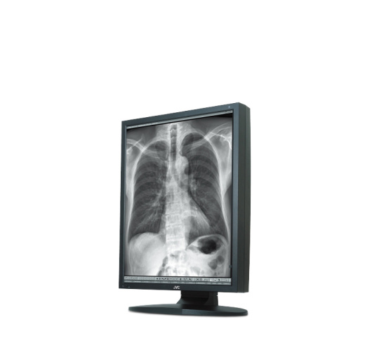 Медицинский монитор JVC MS35i2