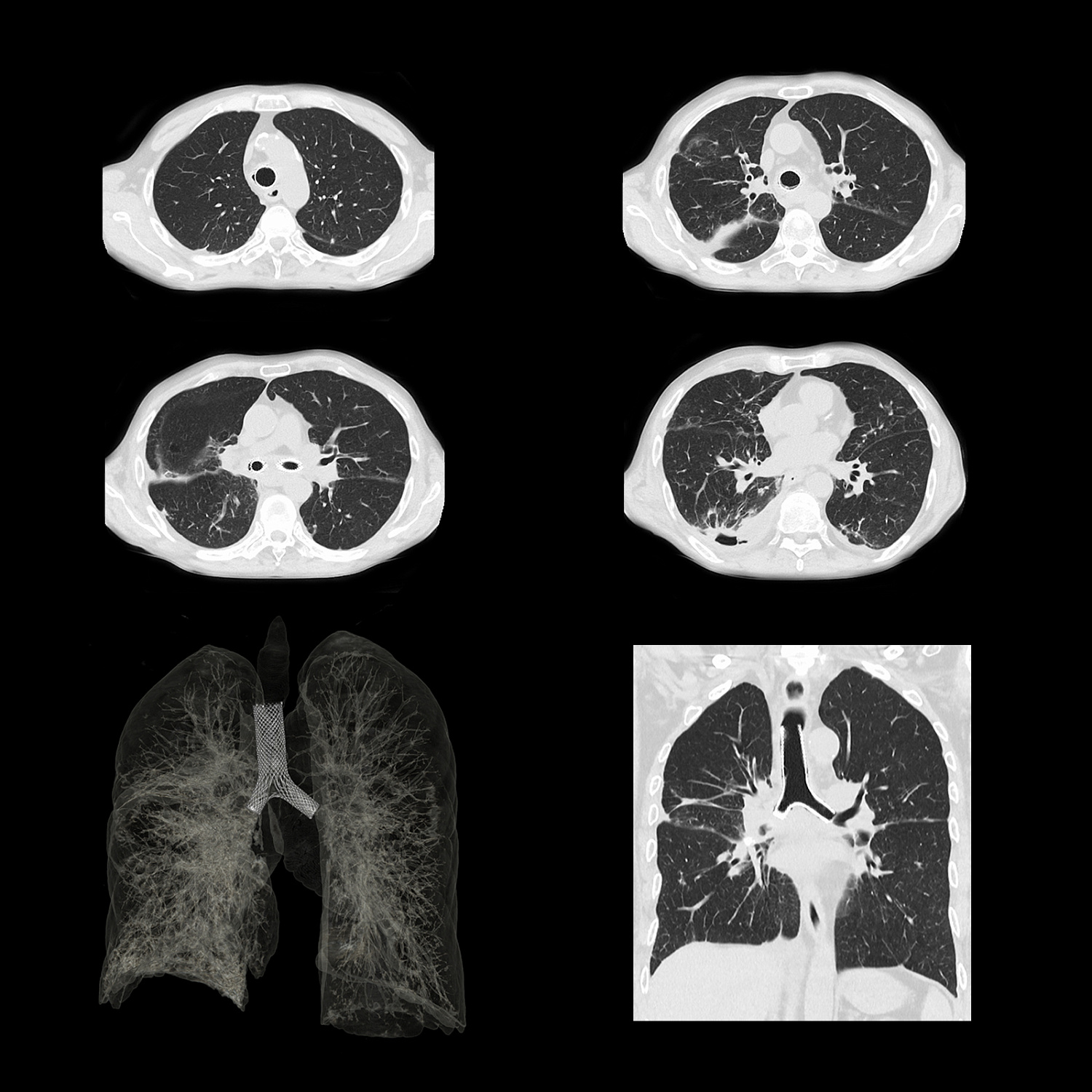 Компьютерный томограф Canon Aquilion ONE (PRISM Edition)