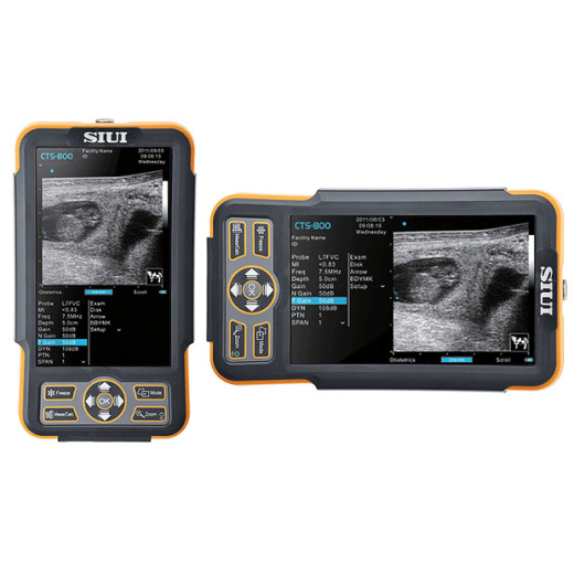 Ветеринарный УЗИ сканер SIUI CTS-800