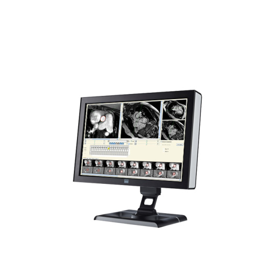 ПО для магнитно-резонансного анализа кровотока Esaote CAAS MR Flow