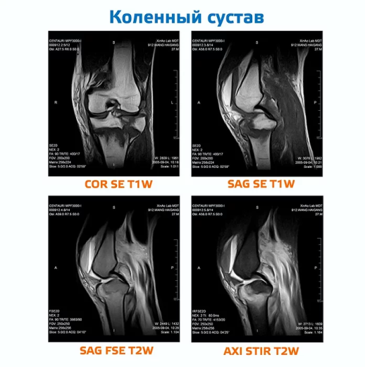 Магнитно-резонансный томограф МРТ-АМИКО300