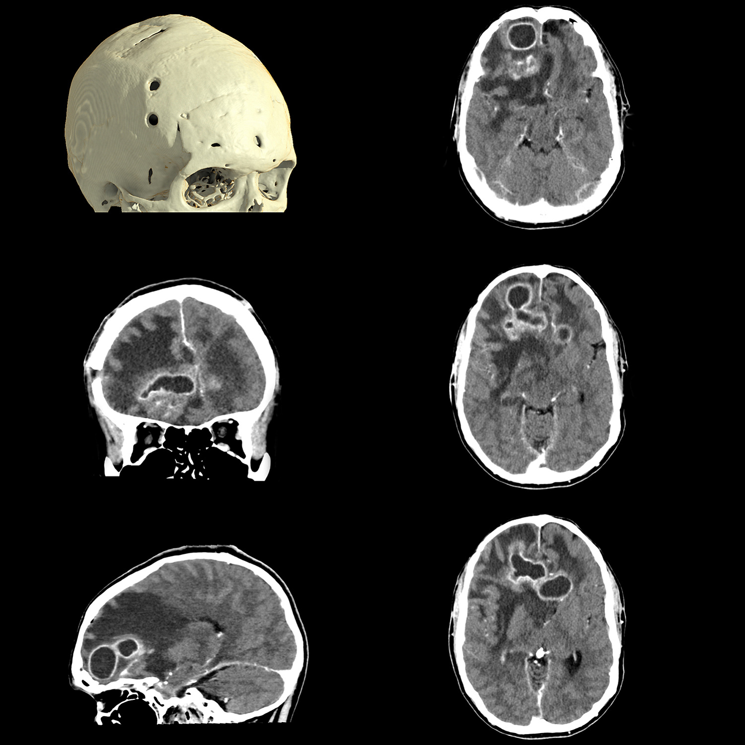 Компьютерный томограф Canon Aquilion ONE (PRISM Edition)