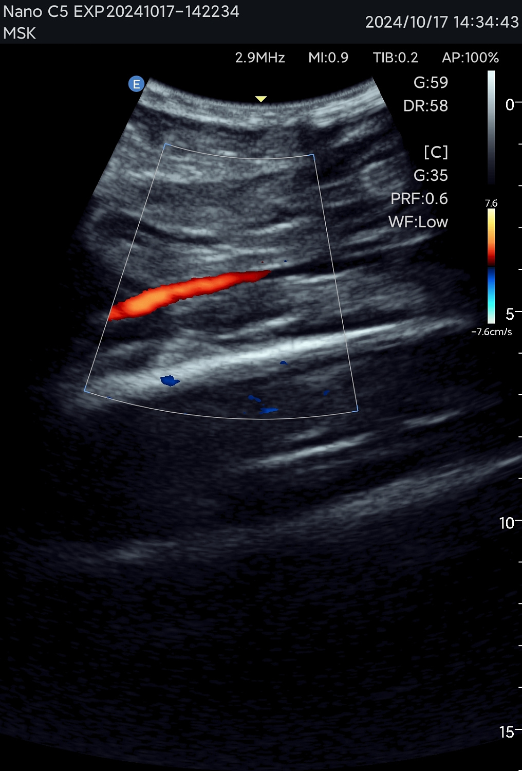 УЗИ аппарат Edan Nano C5 EXP