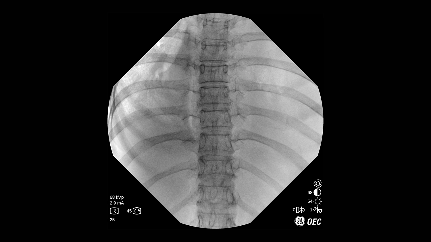 Мобильный рентгеновский аппарат с С-дугой GE OEC One CFD
