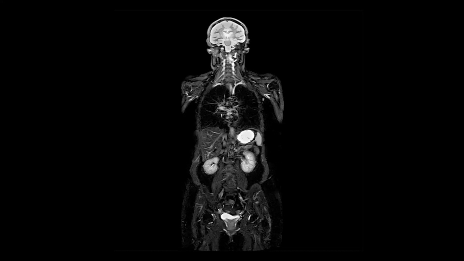 Магнитно-резонансный томограф Siemens MAGNETOM Altea