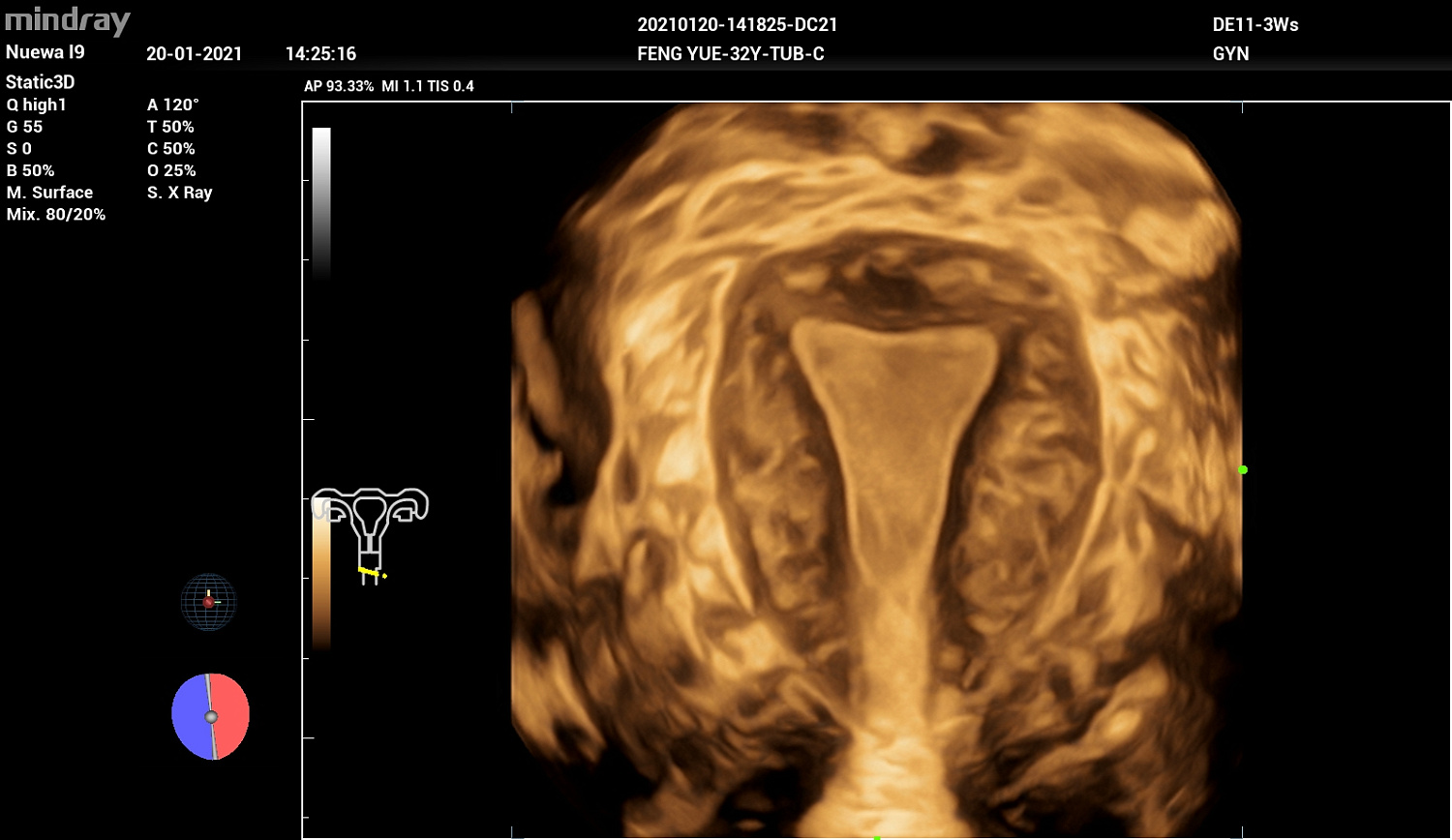 Ультразвуковой аппарат Mindray Imagyn I9