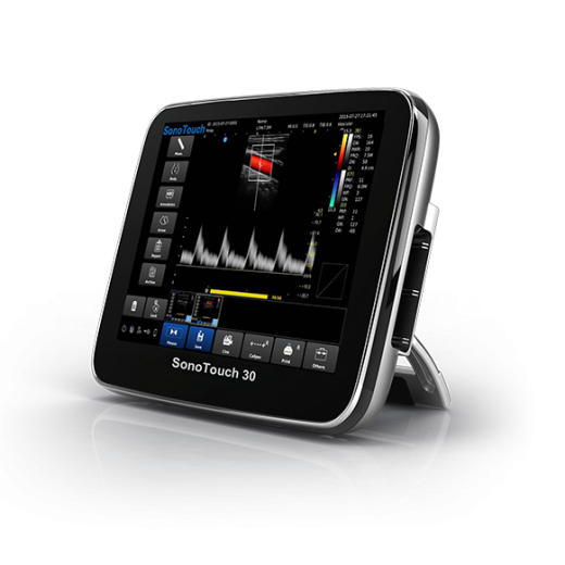 УЗИ аппарат CHISON SonoTouch 30 (ECO 3)