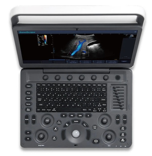 УЗИ аппарат SonoScape E1