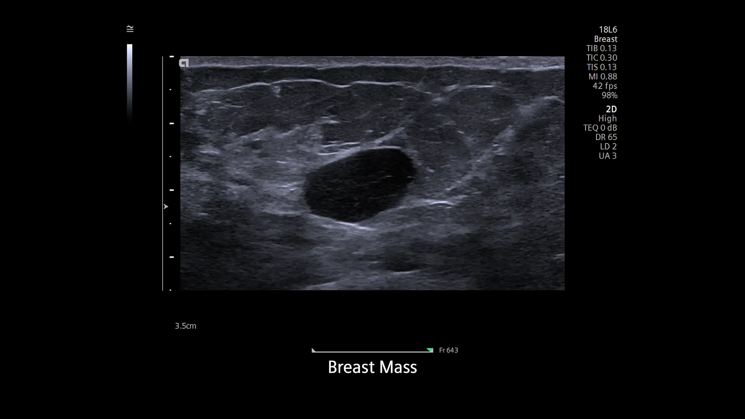 Ультразвуковая система Siemens ACUSON Redwood