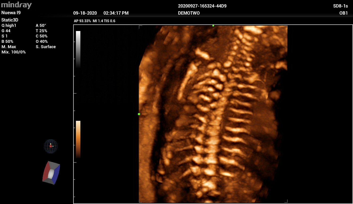 Ультразвуковой аппарат Mindray Imagyn I9