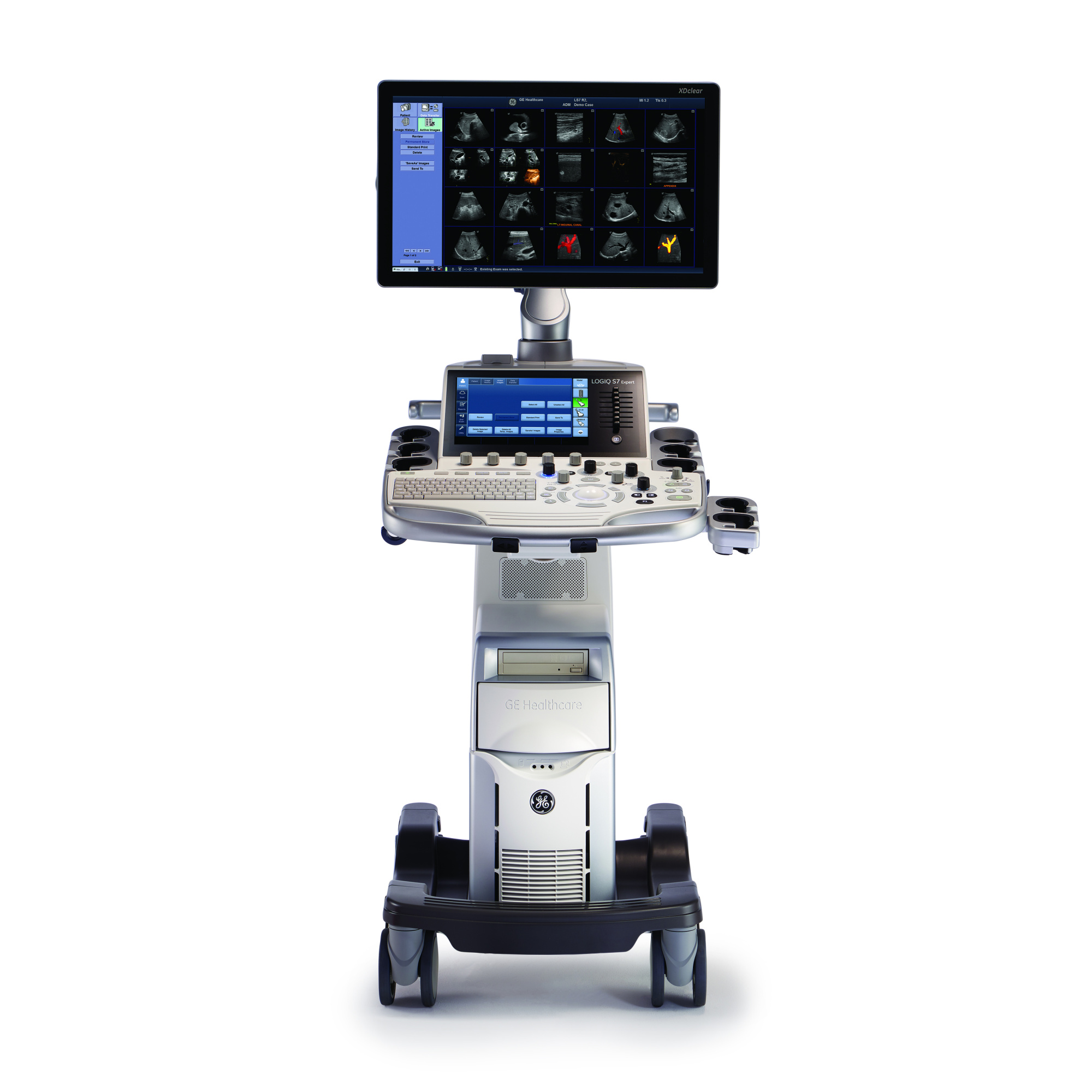 Ультразвуковая диагностическая система GE Healthcare LOGIQ S7 XDclear