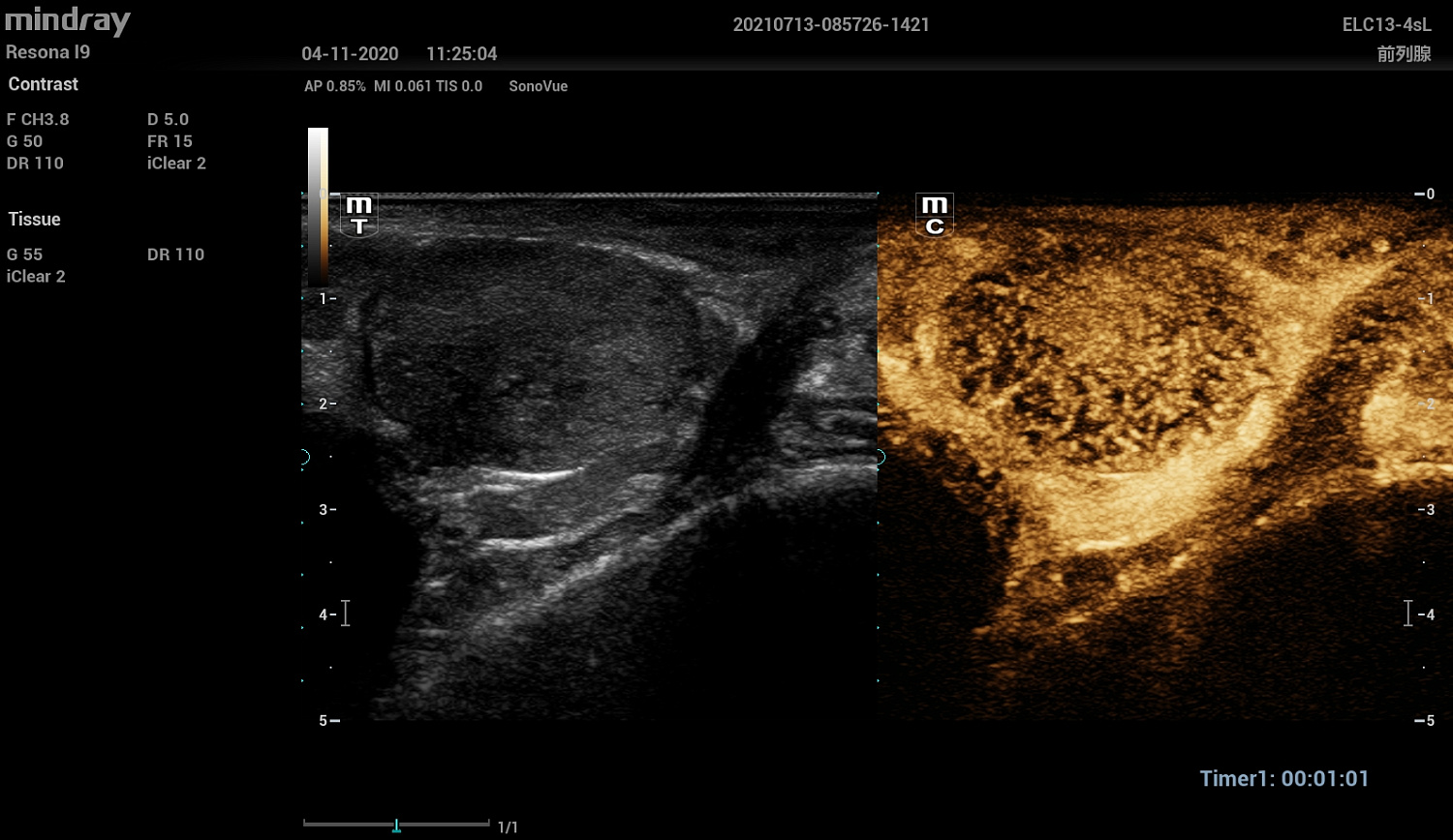 Ультразвуковой аппарат Mindray Resona I9