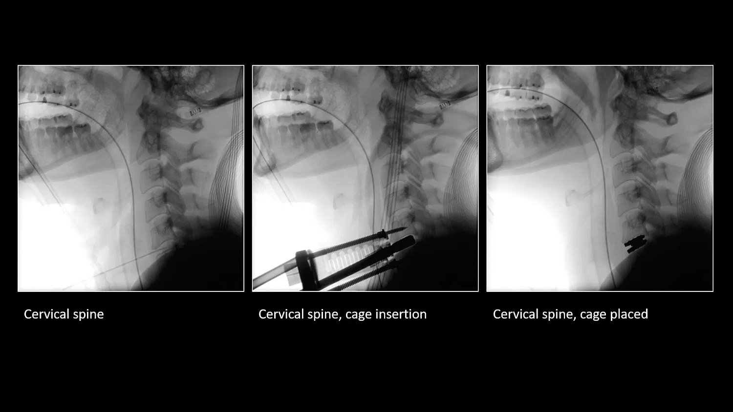 Мобильный рентгеновский аппарат с С-дугой Siemens Cios Select