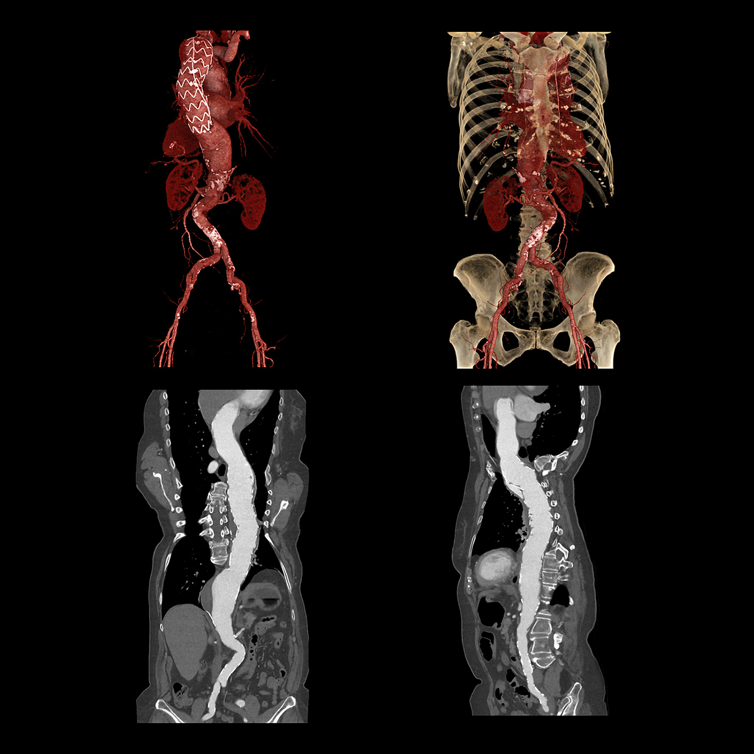 Компьютерный томограф Canon Aquilion ONE (PRISM Edition)