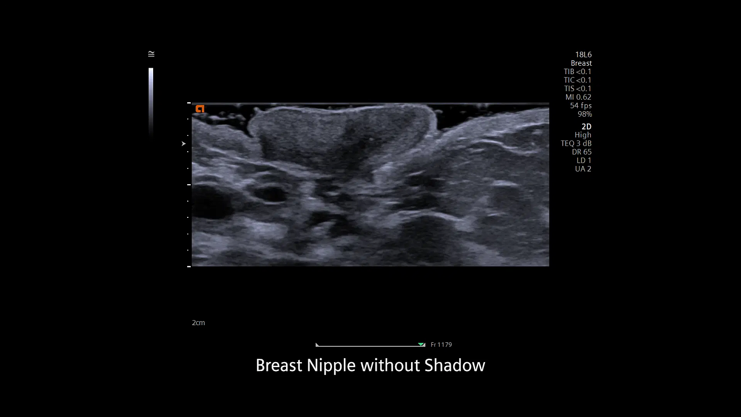 Ультразвуковая система Siemens ACUSON Redwood