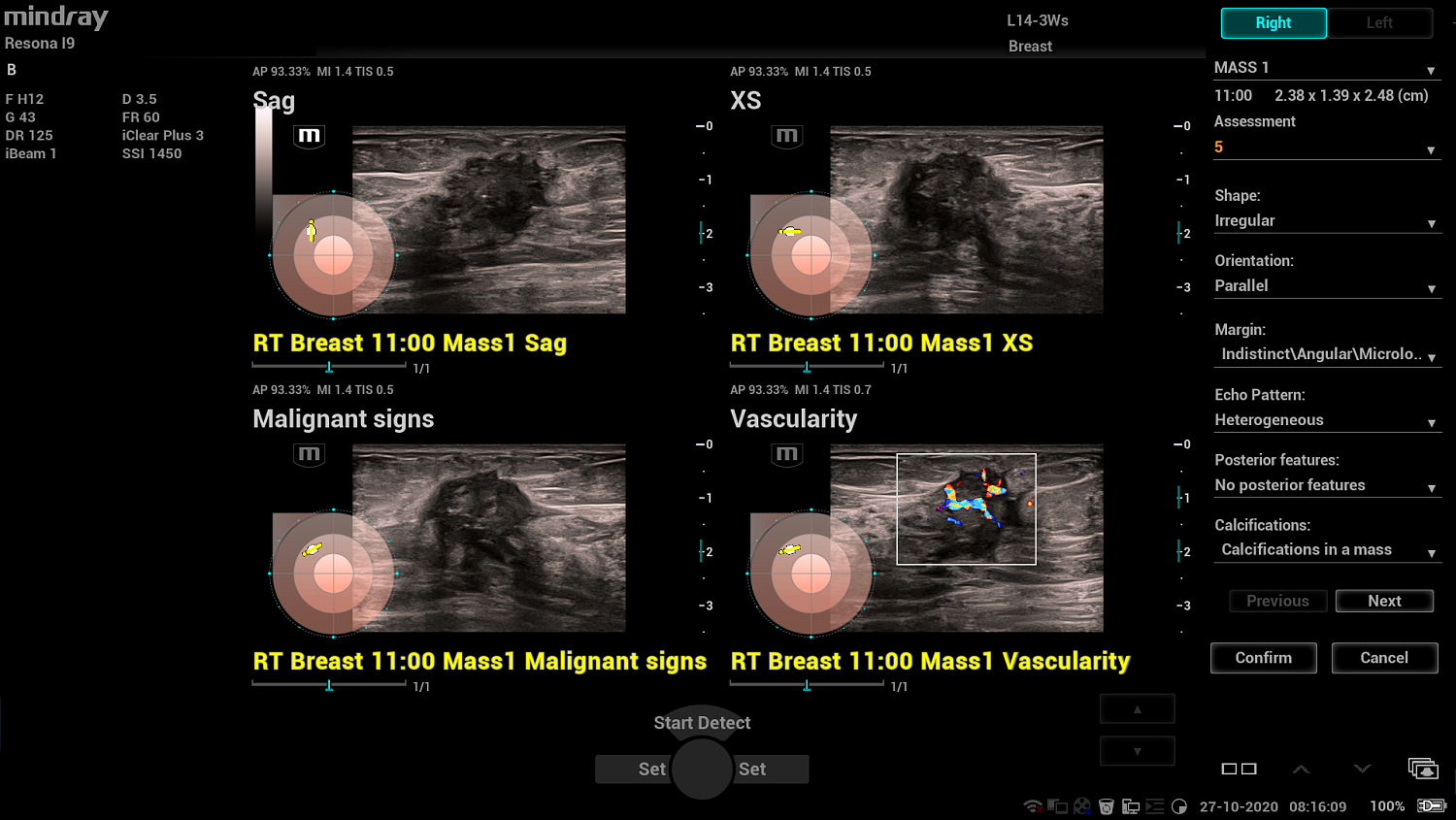 Ультразвуковой аппарат Mindray Resona I9