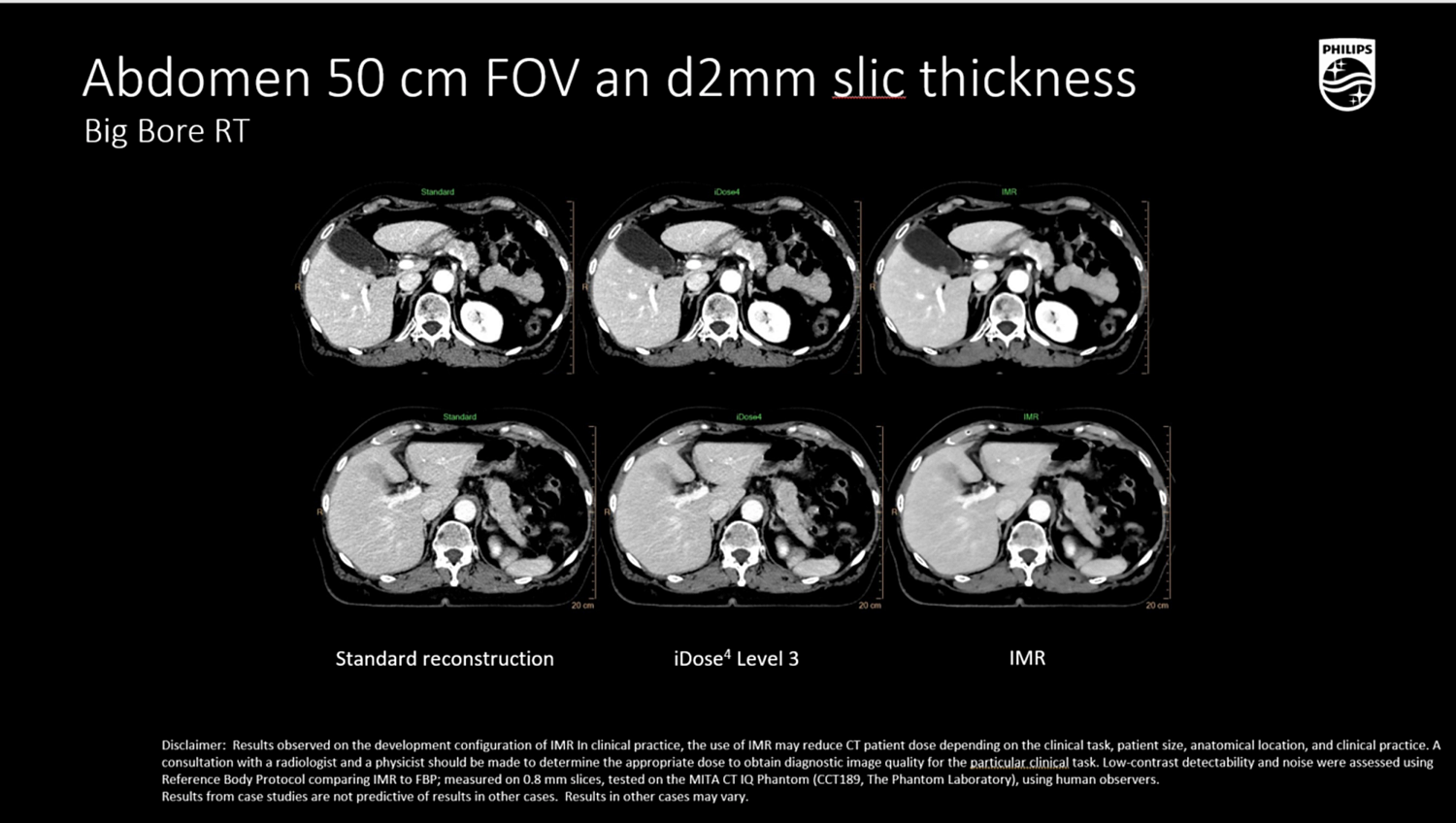 Компьютерный томограф Philips CT Big Bore