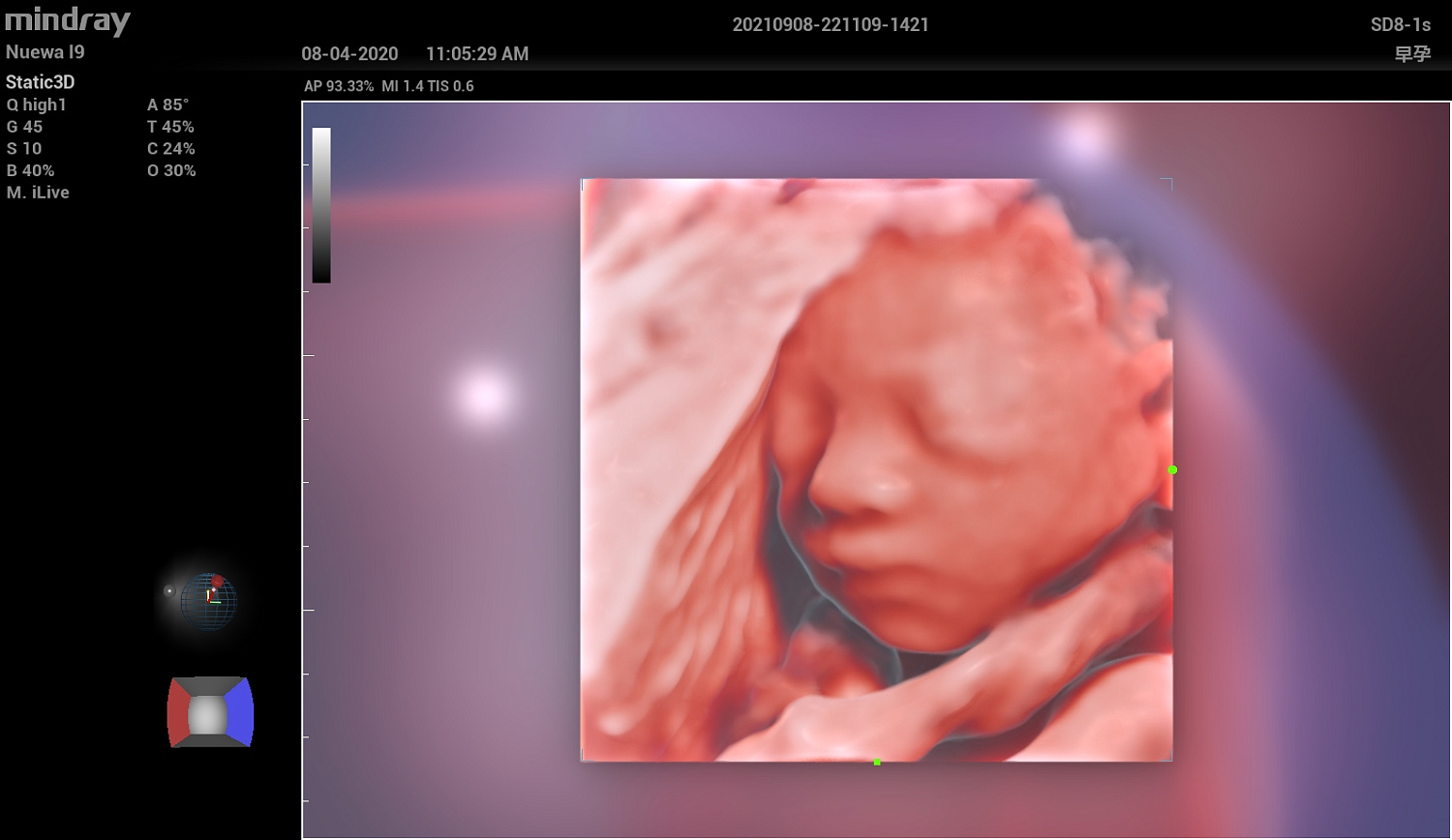 Ультразвуковой аппарат Mindray Imagyn I9