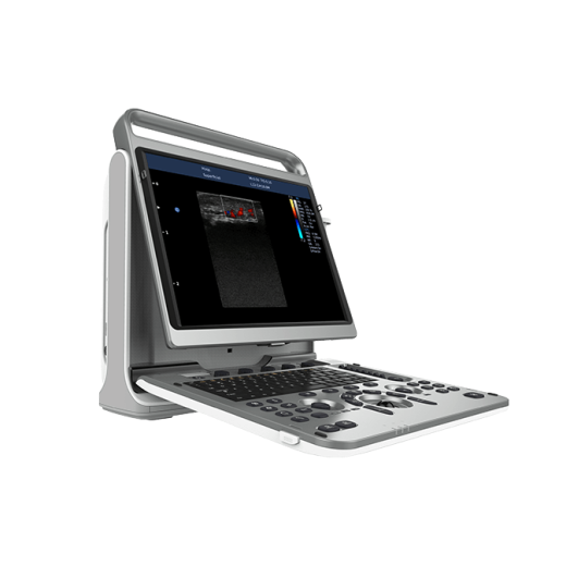 УЗИ аппарат CHISON EBit 50