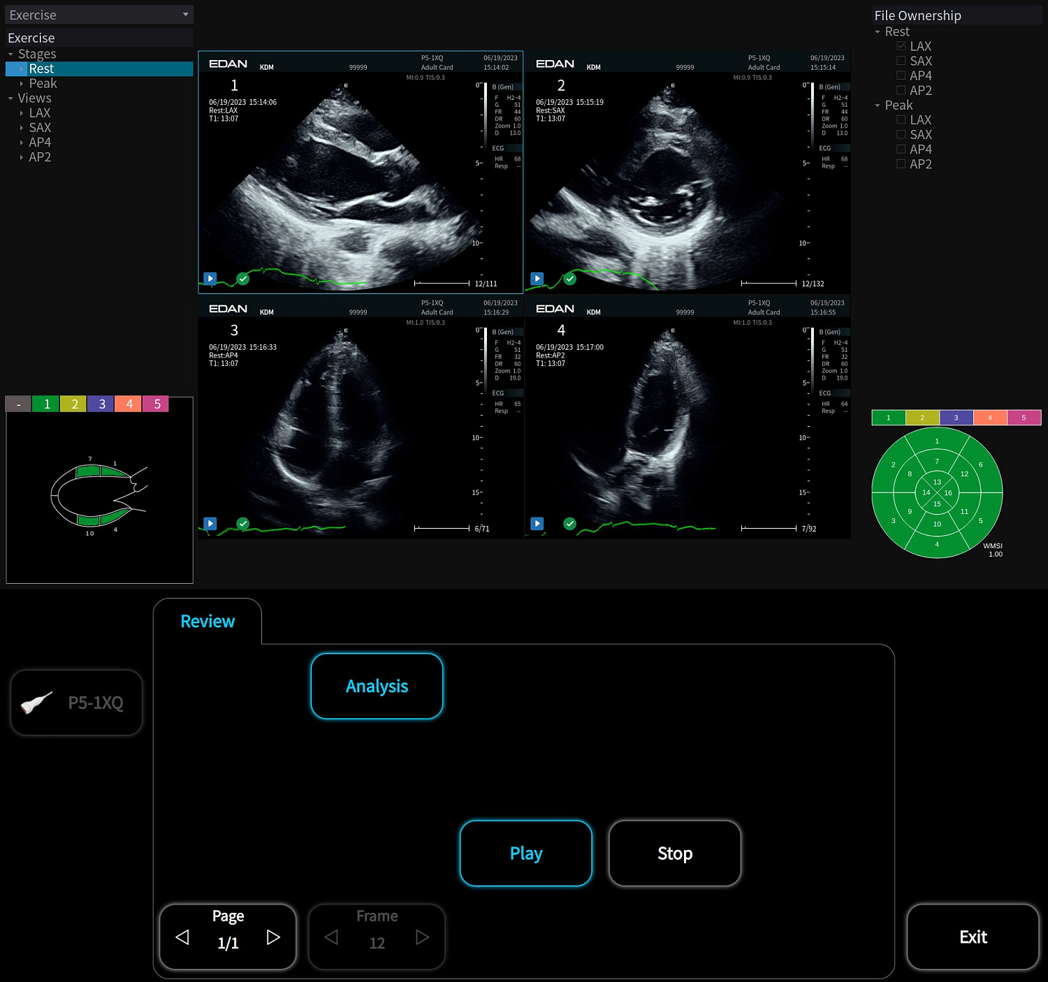 Аппарат УЗИ Edan Acclarix AX8