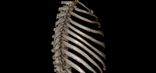 Компьютерный томограф ADVIN Ventum 32S