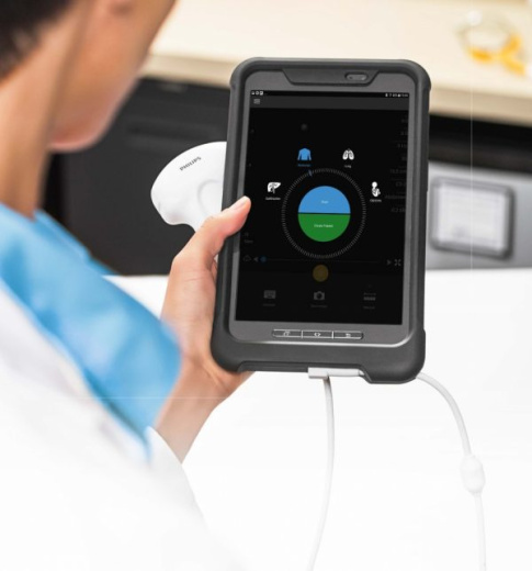 Мобильная ультразвуковая система Philips Lumify