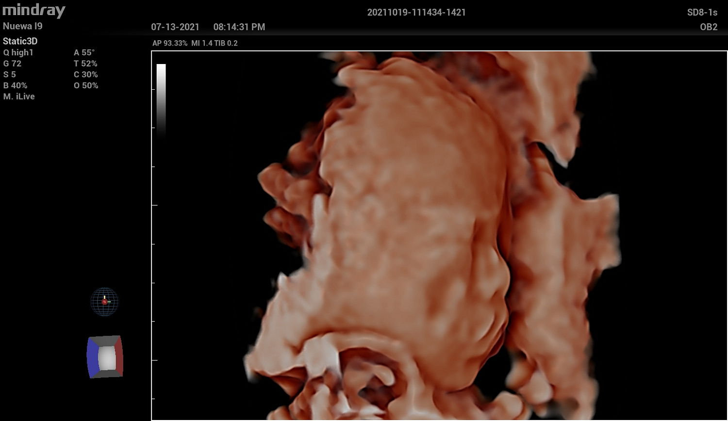 Ультразвуковой аппарат Mindray Imagyn I9
