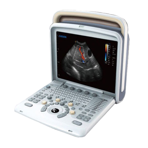 УЗИ аппарат Chison SonoTouch 50