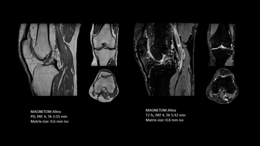 Магнитно-резонансный томограф Siemens MAGNETOM Altea