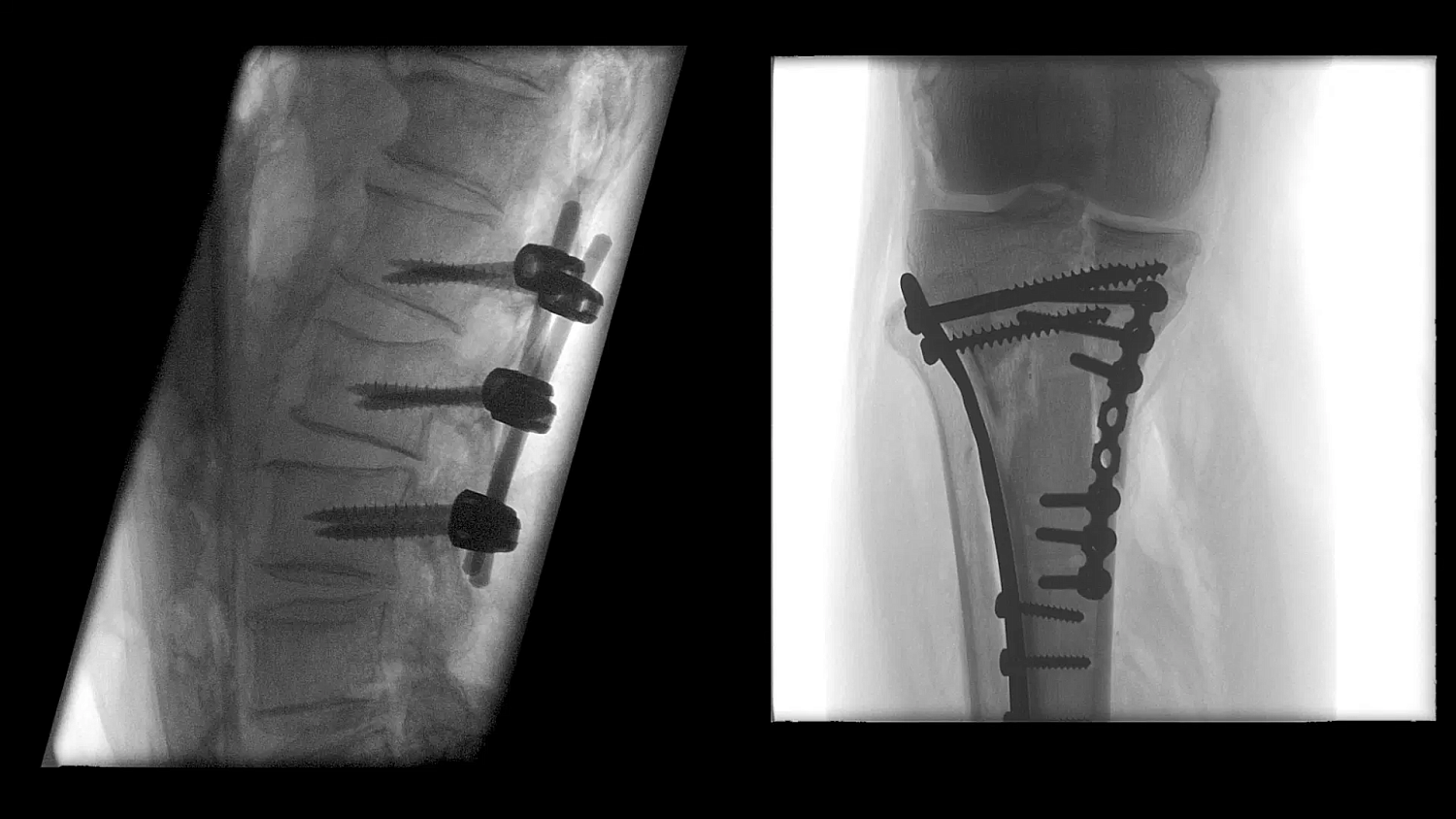 Мобильный рентгенохирургический аппарат с С-дугой Siemens Cios Flow