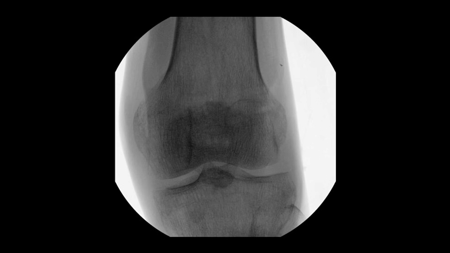 Мобильный рентгеновский аппарат с С-дугой GE OEC Elite MiniView