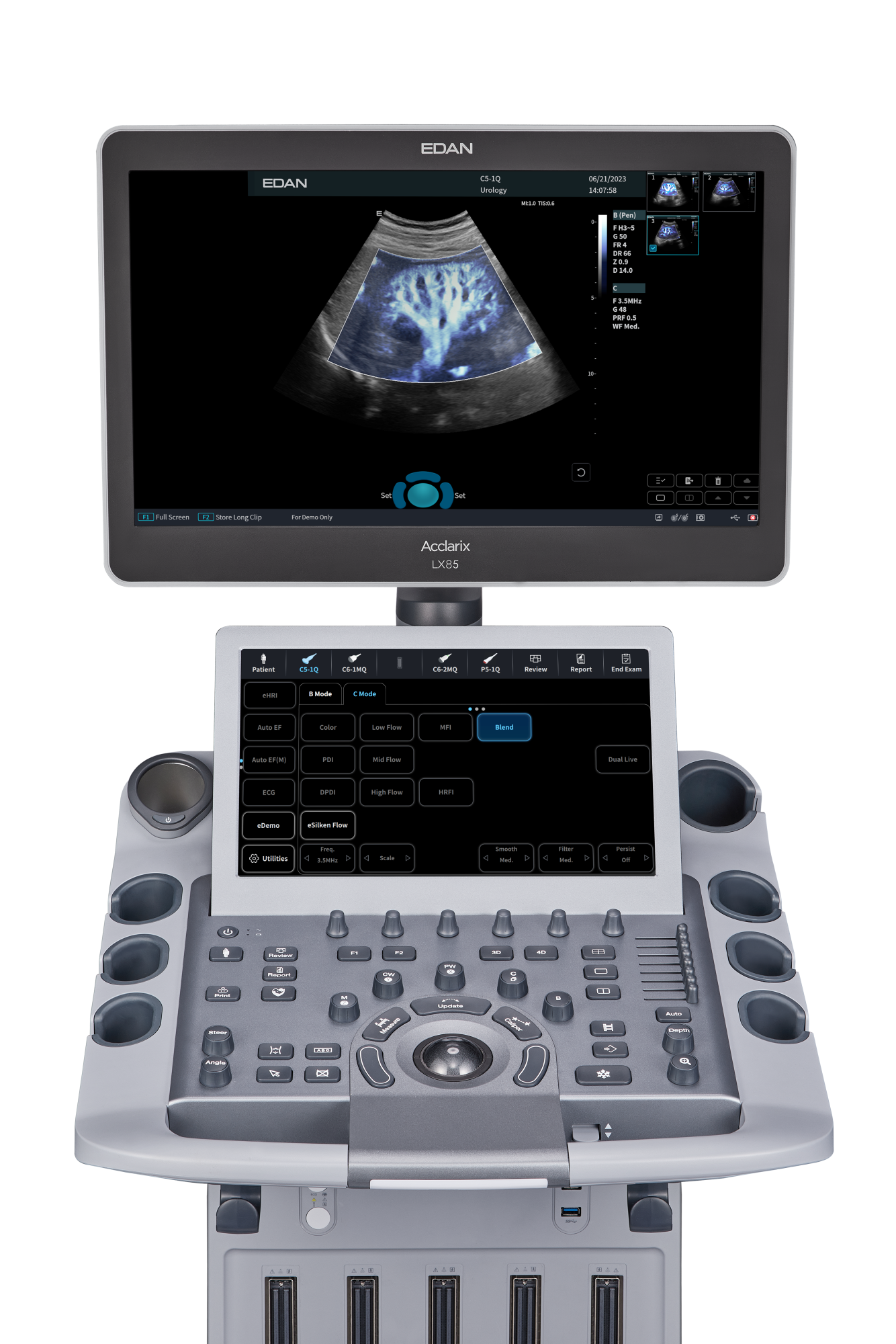 Ультразвуковая система Edan Acclarix LX85