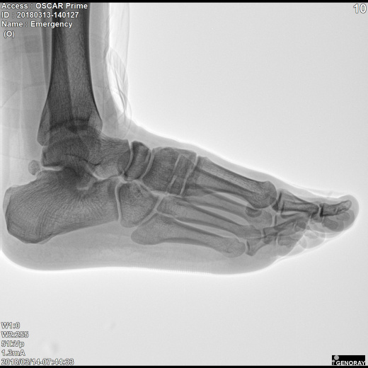 С.П. Гелпик «РЕНЕКС» 5,3 кВт мобильный рентгенохирургический аппарат типа С-дуга с плоскопанельным детектором