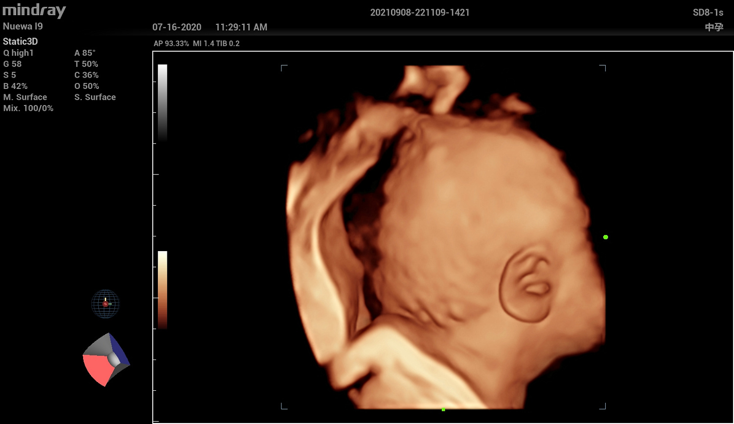 Ультразвуковой аппарат Mindray Imagyn I9