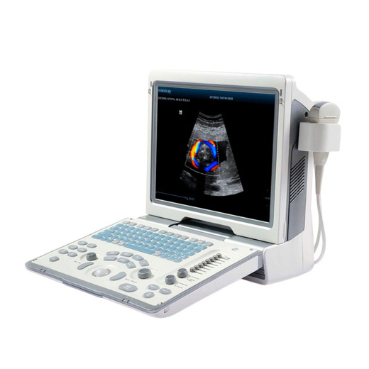 УЗИ аппарат Mindray DP-50 Color