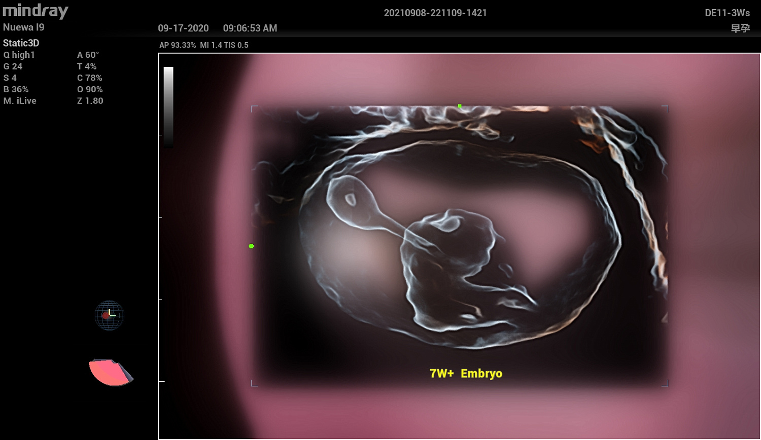 Ультразвуковой аппарат Mindray Imagyn I9