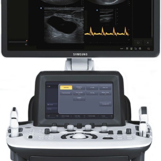 УЗИ аппарат Samsung UGEO H60