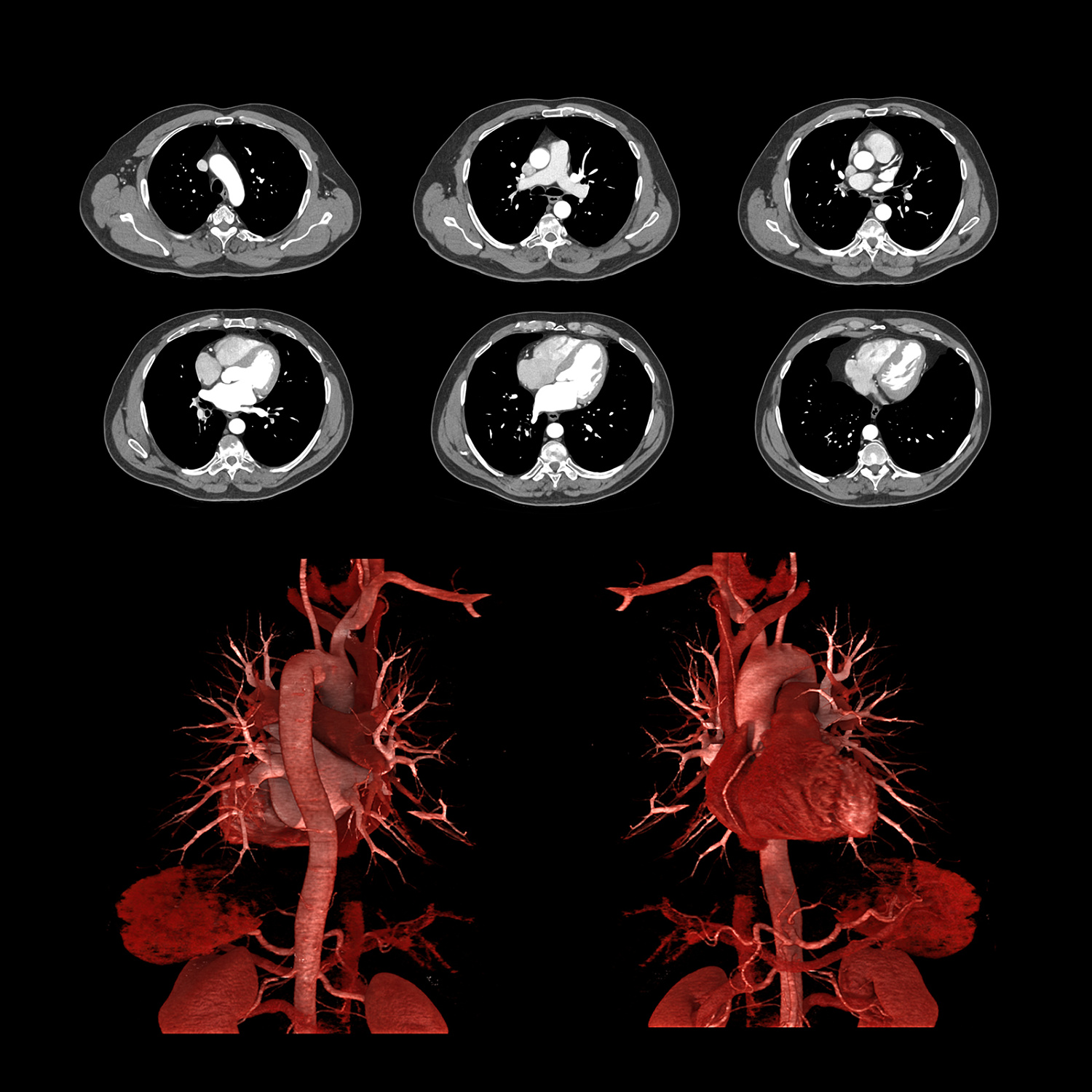 Компьютерный томограф Canon Aquilion ONE (PRISM Edition)