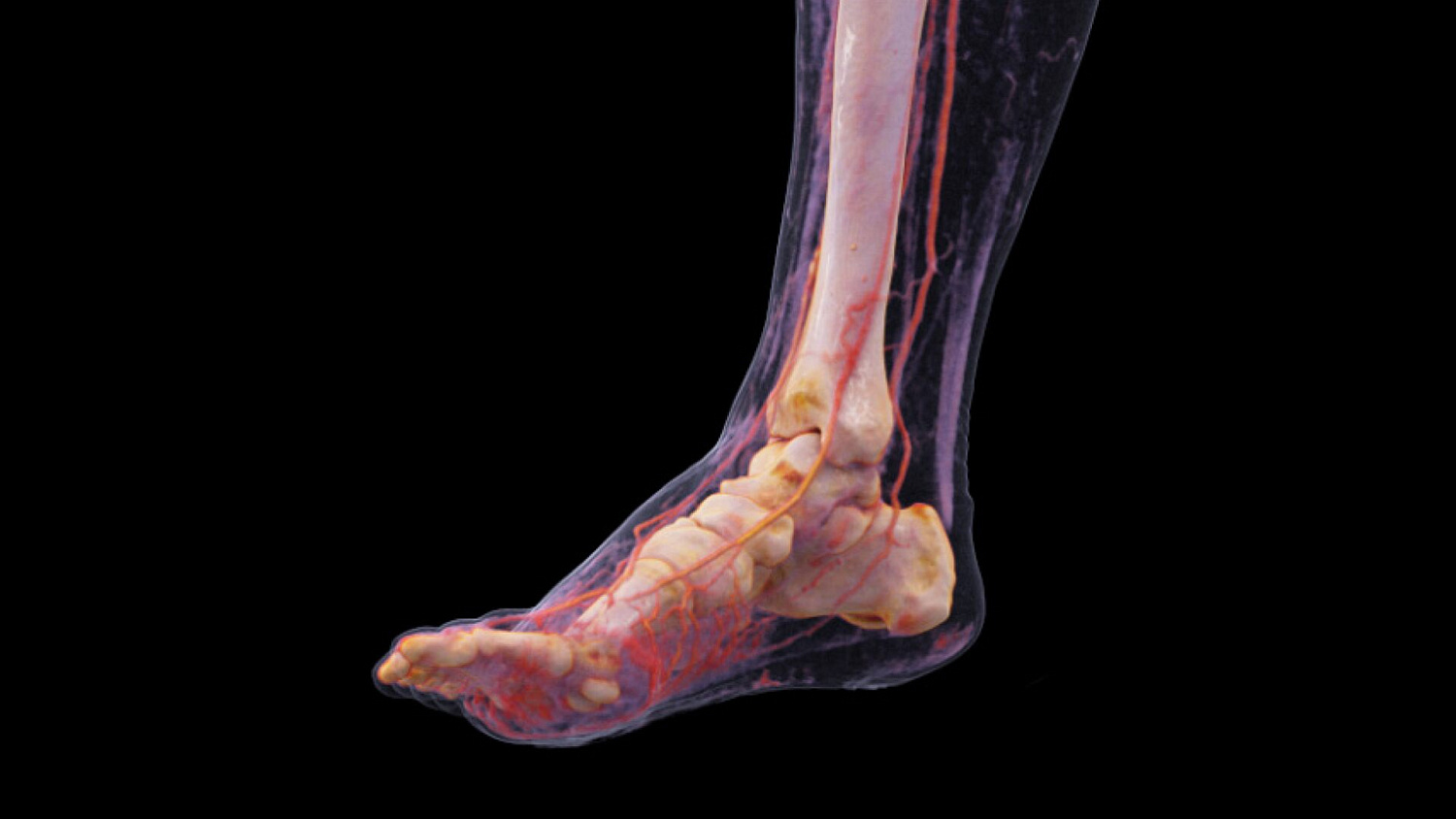 Компьютерный томограф Siemens SOMATOM Force