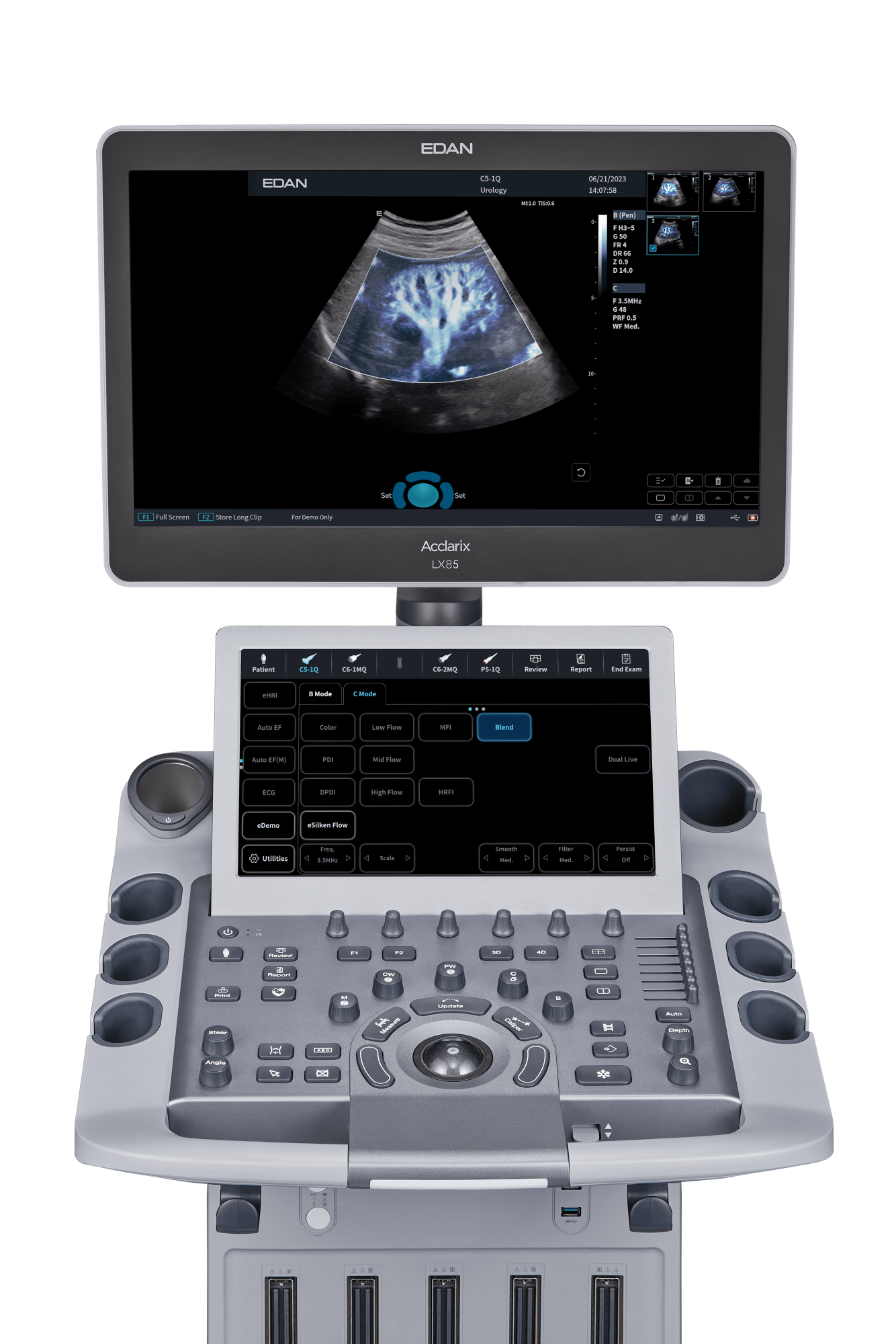 Ультразвуковая система Edan Acclarix LX85