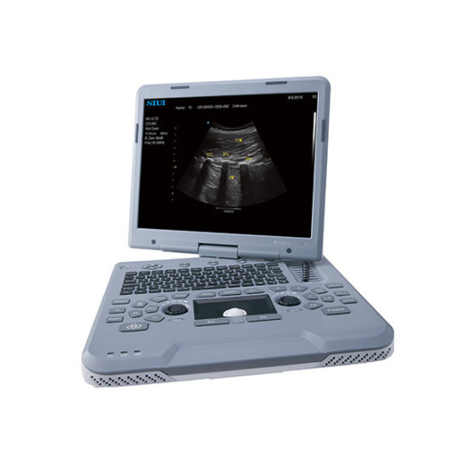 УЗИ аппарат SIUI Apogee 1000 Neo