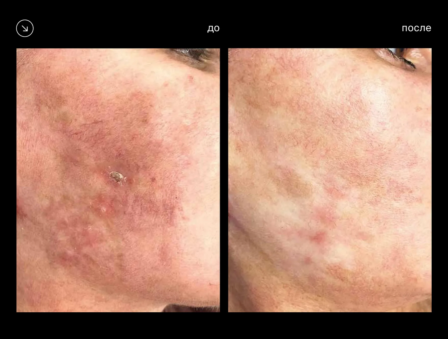 Eunsung Global ClearLight