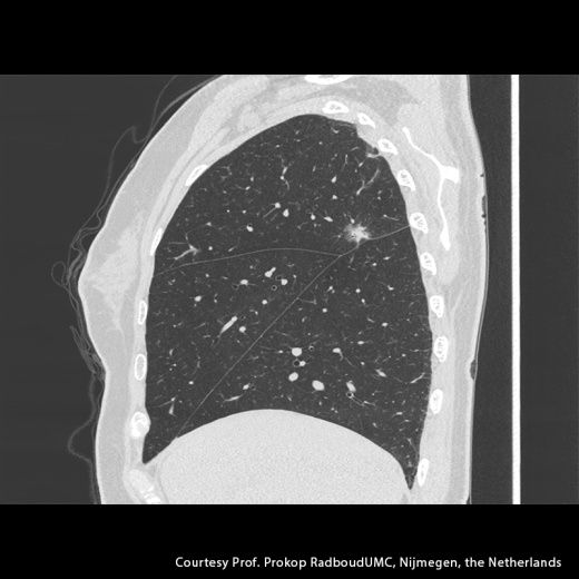 Компьютерный томограф Canon Aquilion Precision