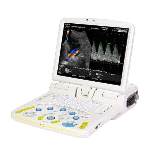 Портативный ультразвуковой сканер Hitachi Noblus