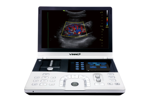Портативный УЗИ аппарат VINNO 6