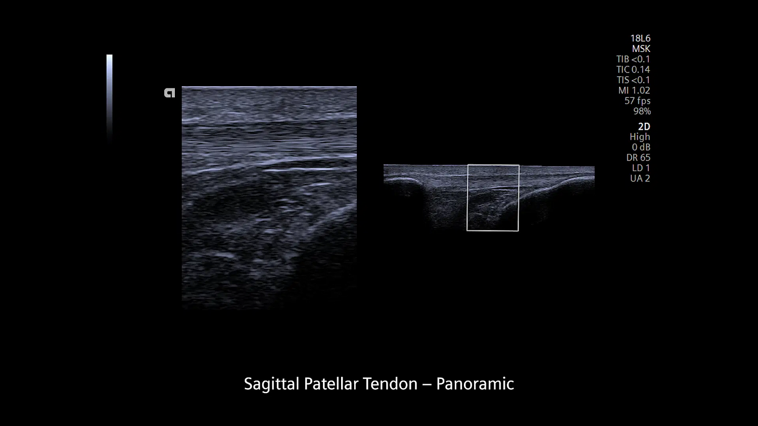 Ультразвуковая система Siemens ACUSON Redwood
