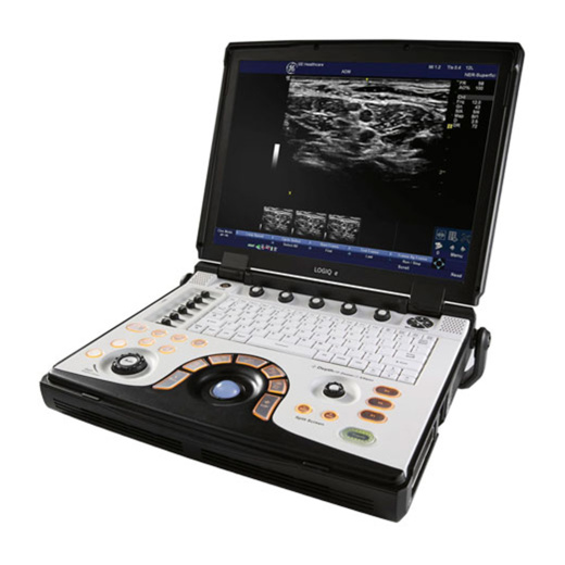 Портативная ультразвуковая система GE Healthcare LOGIQ E