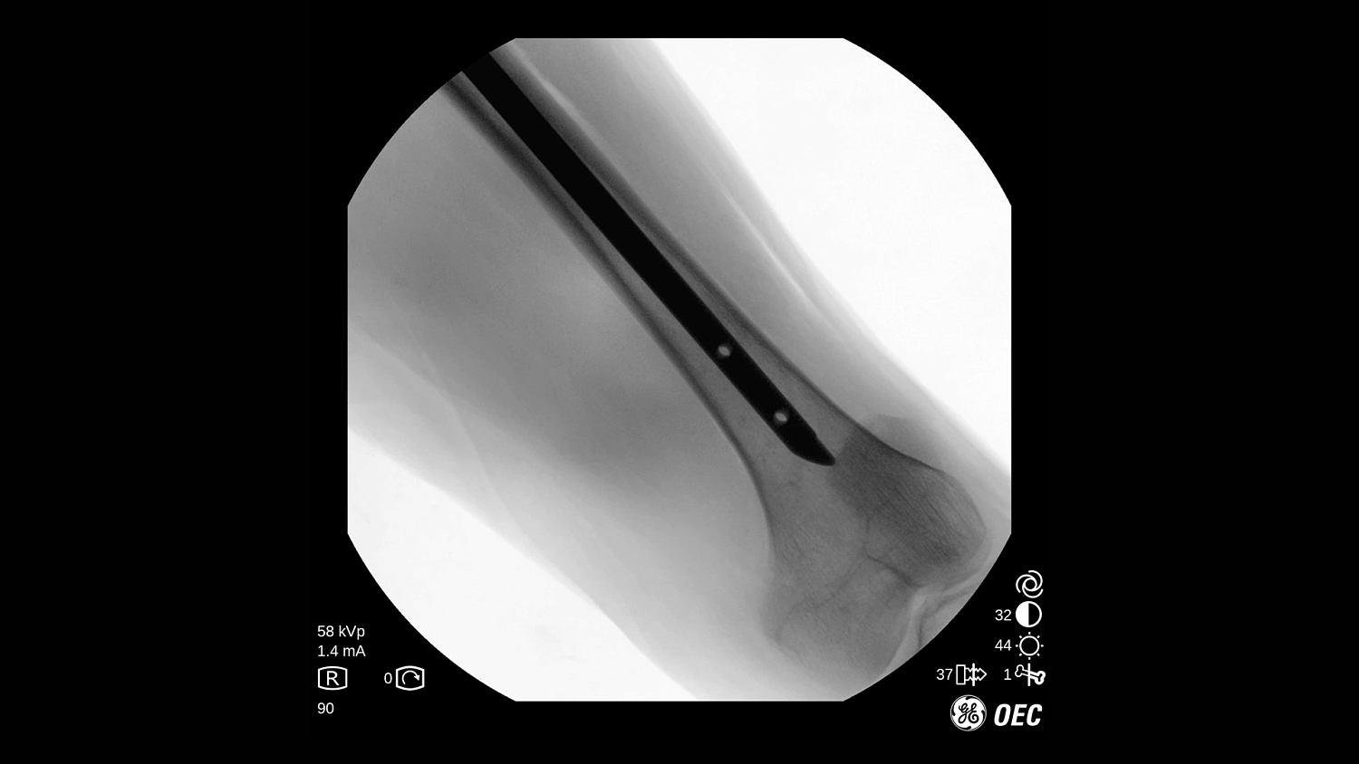 Мобильный рентгеновский аппарат с С-дугой GE OEC One CFD